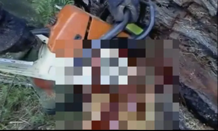 Bărbat rănit după ce și-a scăpat drujba peste picior