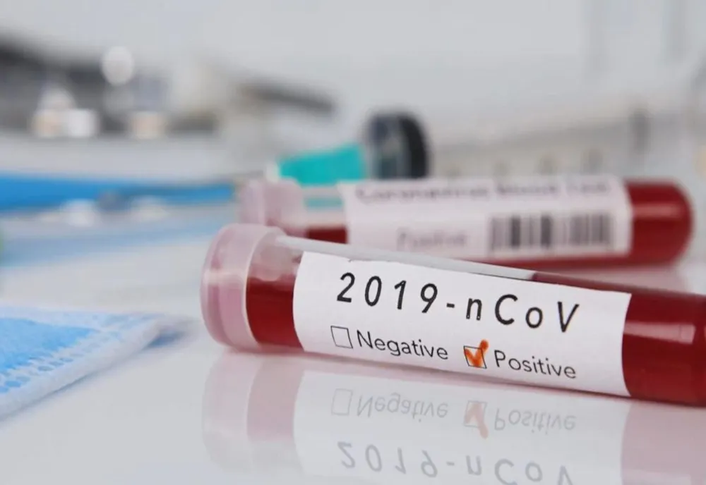 27 de cadre medicale de la Spitalul Județean Suceava depistate pozitiv cu coronavirus
