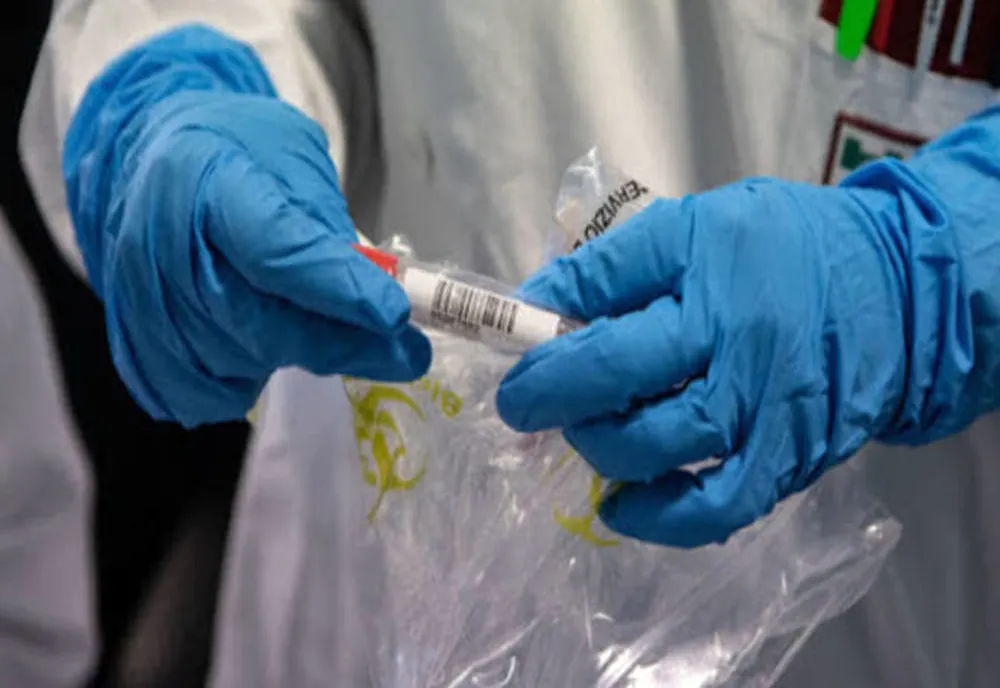 Un bărbat de 71 de ani, al zecelea deces de coronavirus în județul Suceava