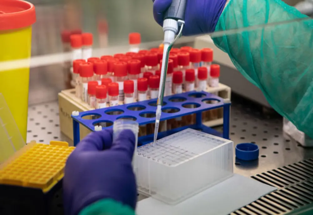 Studiu MedLife: 20% din populația Sucevei a fost imunizată natural pentru COVID 19