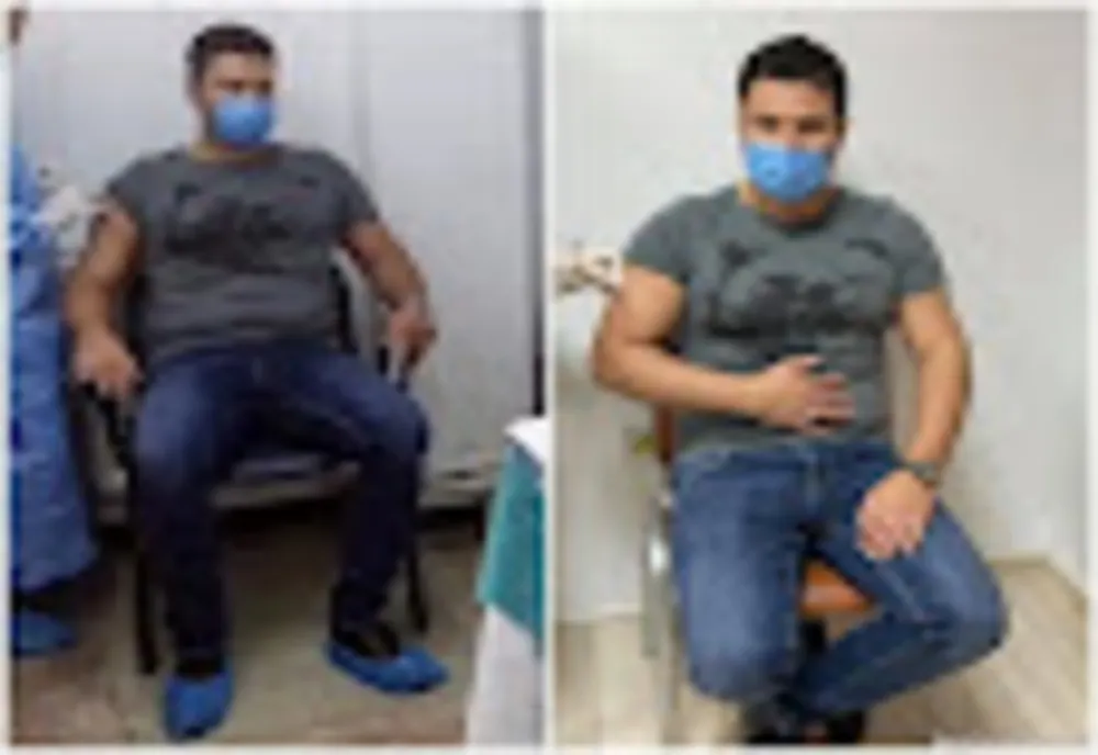 FOTO Un primar și-a editat pozele de la vaccinare - Ce a omis