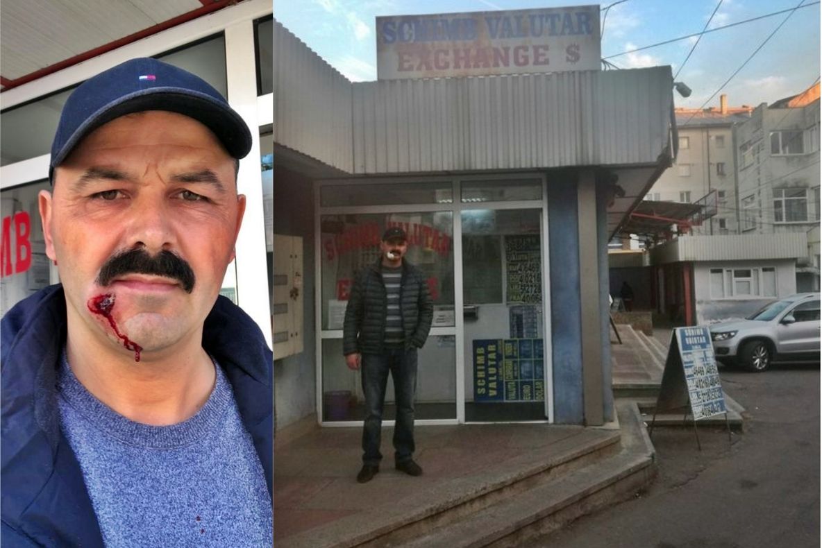 Valutistul care și-a împușcat fratele rival în față, eliberat după o noapte în arestul Poliției