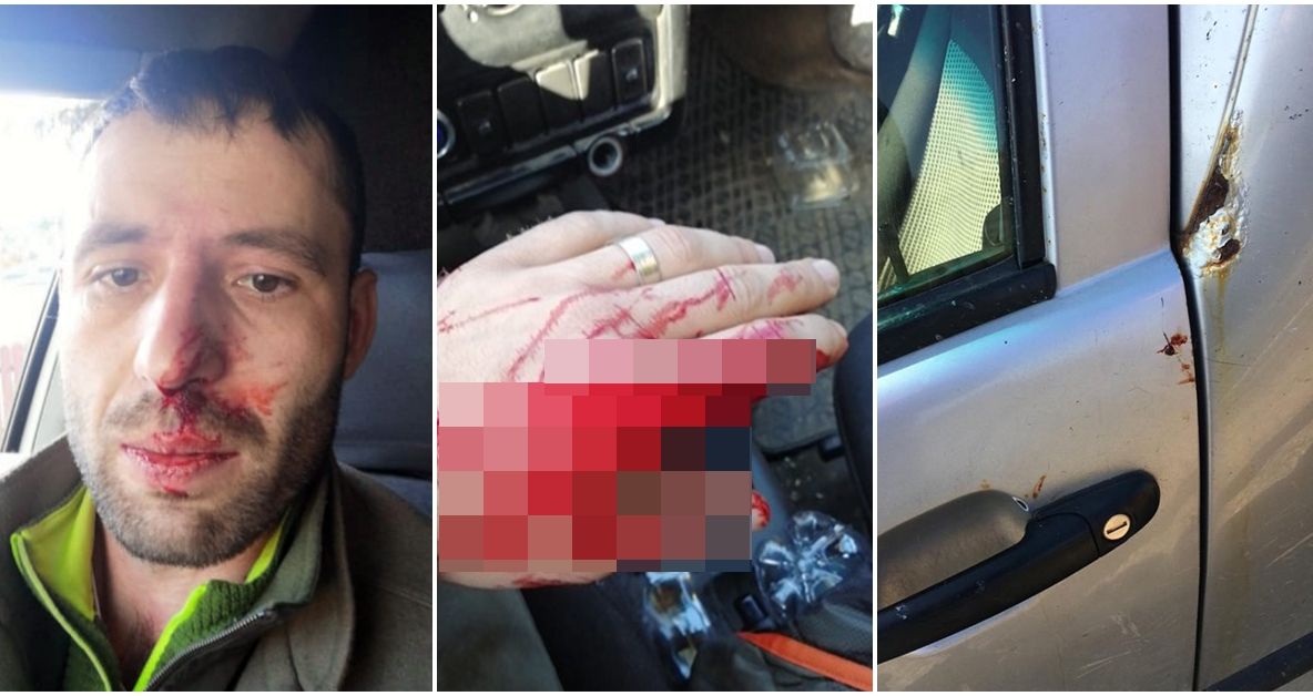 Pădurar care apare într-o investigație jurnalistică, bătut de hoții de lemne din Moldovița