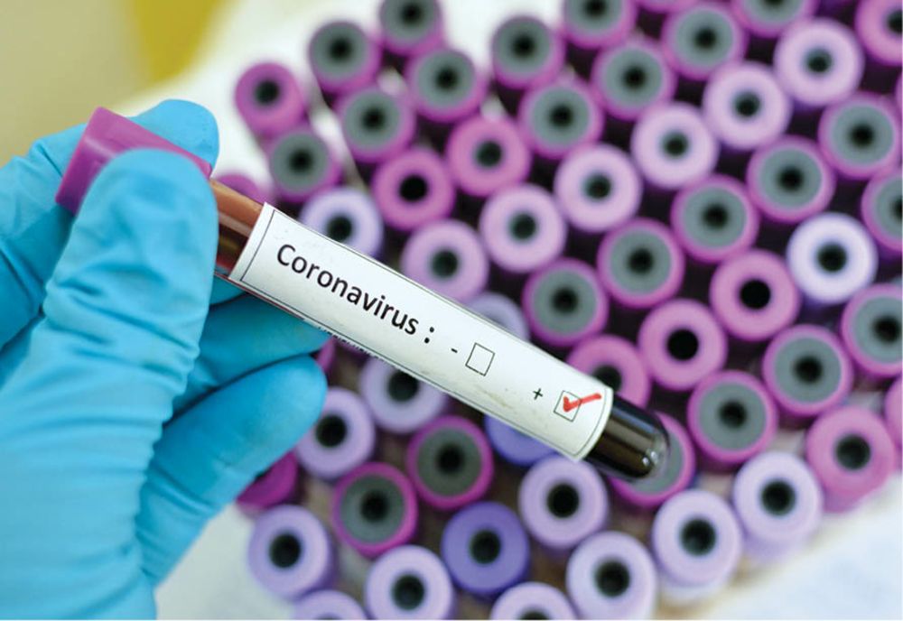 În ultimele 24 de ore au fost testate pentru coronavirus 80 persoane, 14 au fost confirmate pozitiv