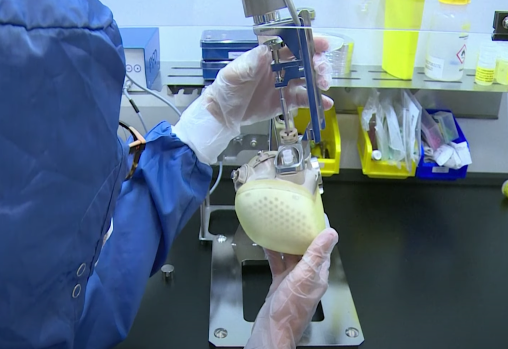 Premieră: A fost făcut transplantul cu o inimă ARTIFICIALĂ