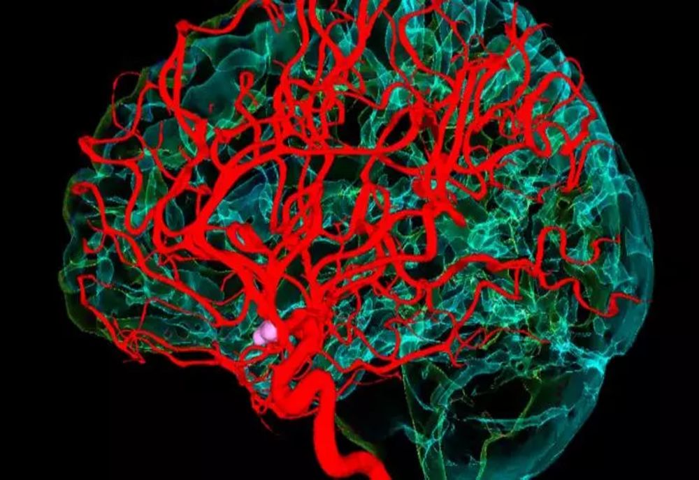 Accident Vascular Cerebral. Cum te recuperezi după un AVC. Ce simptome post-AVC poți avea