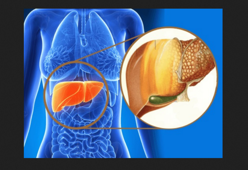 Semnele pe care nu trebuie să le ignorăm și care ar putea trăda o boală de ficat