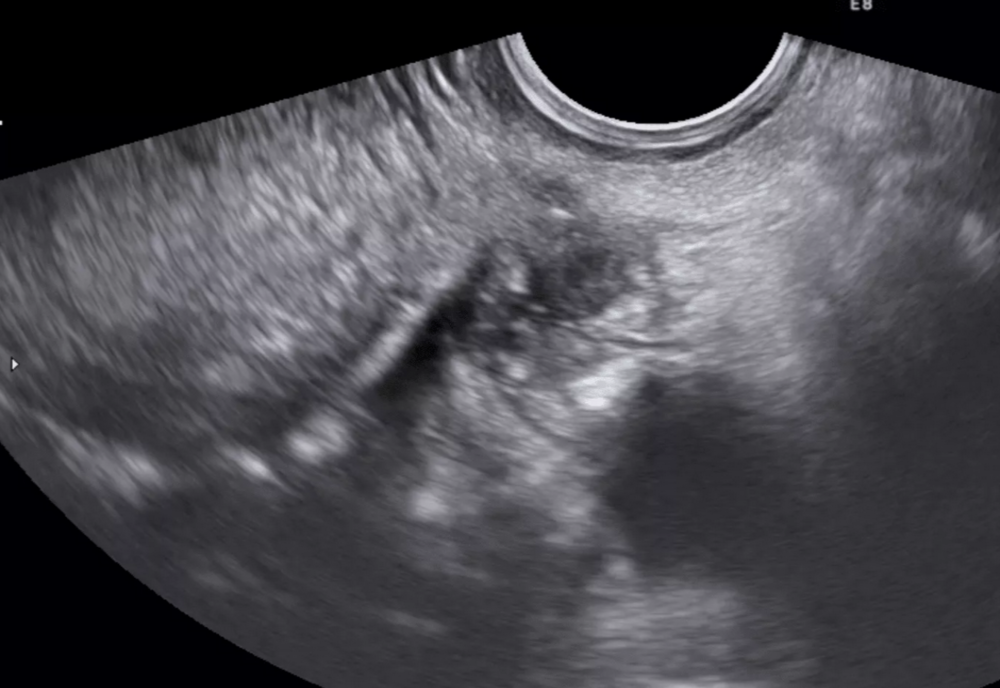 Descoperire revoluționară a cercetătorilor australieni în domeniul medicinei