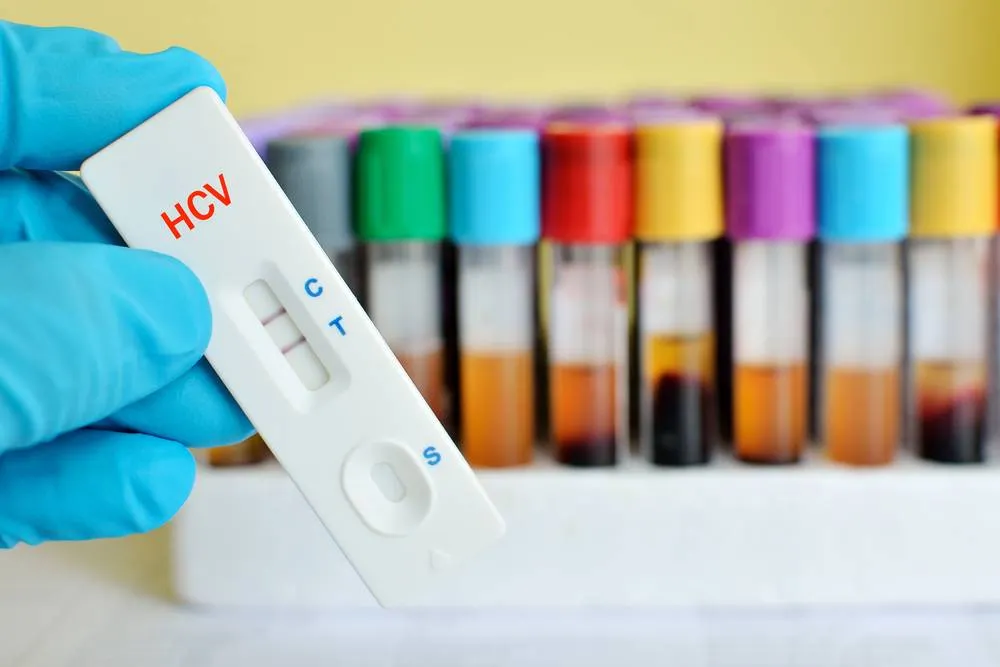 test hepatită C, sursa foto Scoala Pacientilor