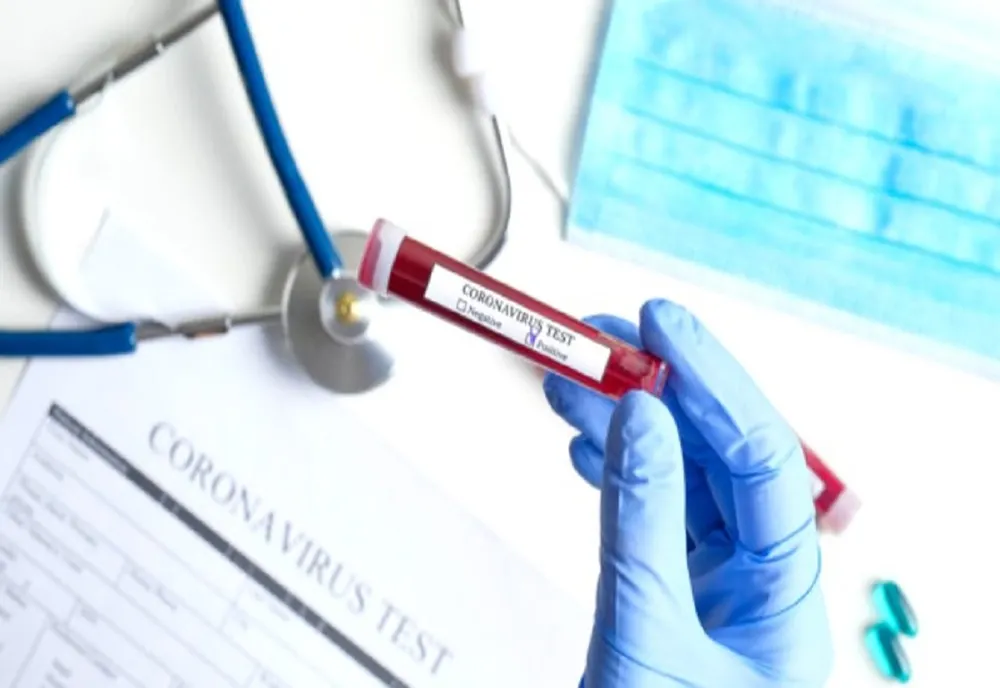 Bilanț coronavirus 15 noiembrie:  2.136 cazuri noi, 195 decese