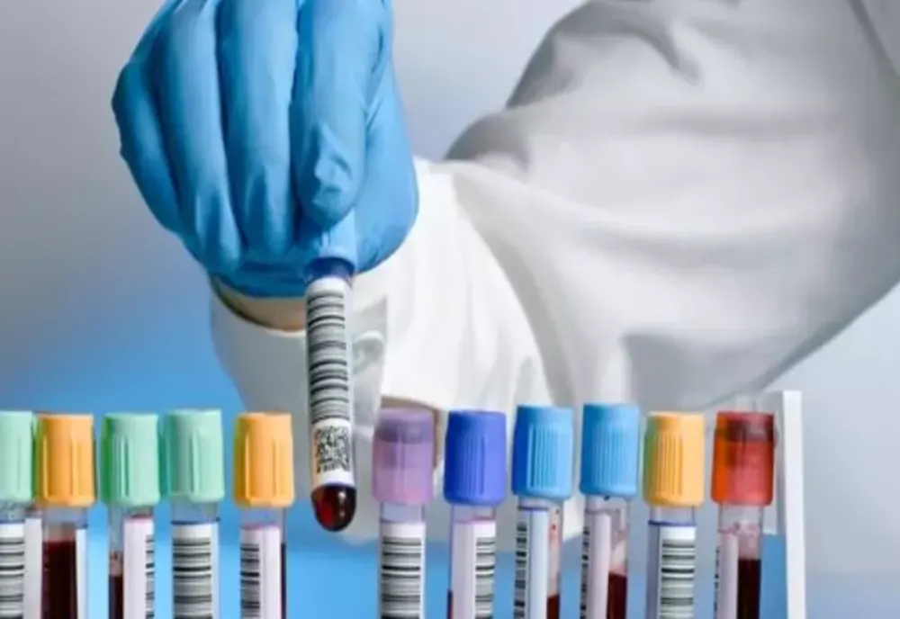 Analizele medicale anuale pe care e bine să le faci în funcție de vârsta ta - Pot preveni problemele de sănătate nedorite