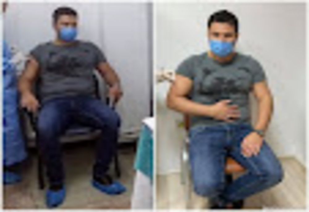 FOTO Un primar și-a editat pozele de la vaccinare - Ce a omis