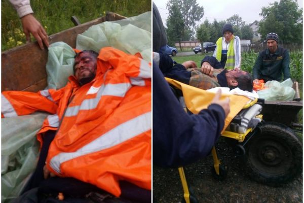 FOTO Tânăr desfigurat în bătaie și călcat cu tractorul, lăsat inconștient într-o baltă de sânge. Polițiștii sunt acuzați că îi protejează pe agresori