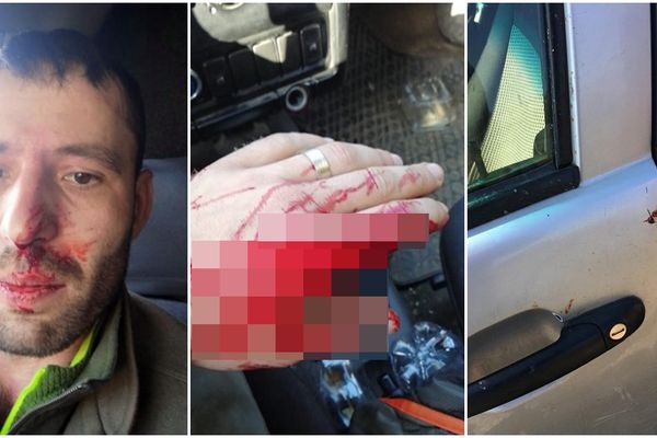 Pădurar care apare într-o investigație jurnalistică, bătut de hoții de lemne din Moldovița