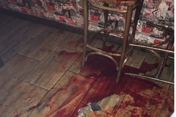 Agent de pază înjunghiat în fața unui bar din Fălticeni VIDEO