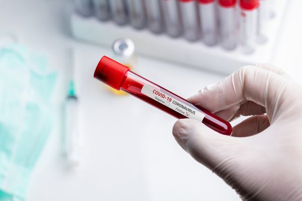 Încă patru cazuri confirmate de coronavirus în județul Suceava