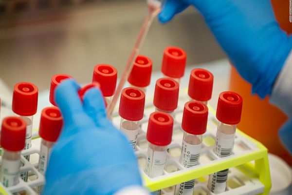 Aproximativ 40 de persoane din Centrul de Recuperare și Reabilitare Neuropsihiatrică Sasca Mică au fost confirmate cu COVID 19