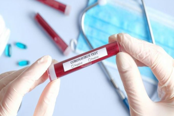 În ultimele 24 de ore, în județul Suceava s-au înregistrat 54 de cazuri noi de coronavirus