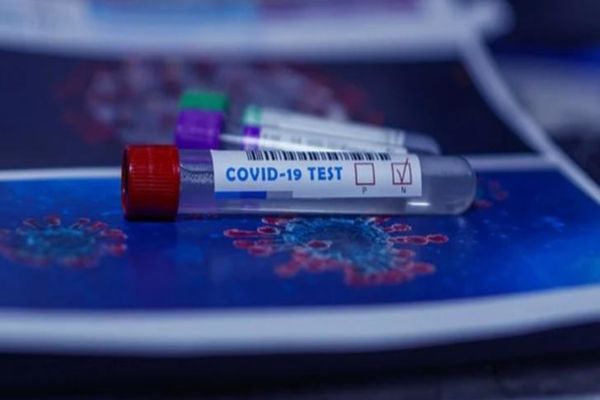 COVID-19. 3.240 de noi cazuri, în ultimele 24 de ore, din doar 11.445 de teste (28,3%)! 130 de pacienți au decedat!