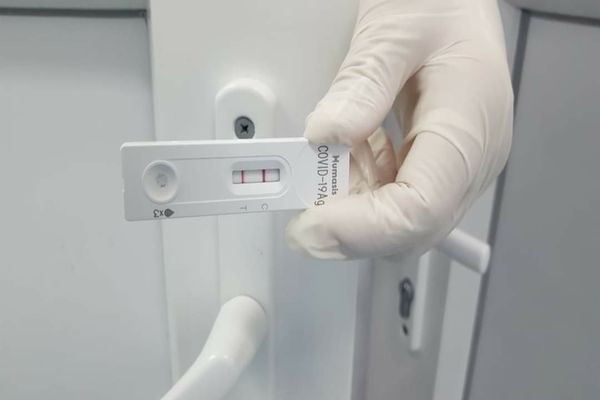 Scădere accentuată a cazurilor de COVID-19 față de săptămâna precedentă