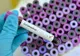 Un român din Italia infectat cu coronavirus A MURIT