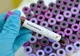 Un angajat de la Centrul de Recuperare și Reabilitare Neuropsihiatrică Costâna diagnosticat cu coronavirus