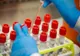 18 suceveni s-au vindecat de coronavirus în ultimele 24 de ore